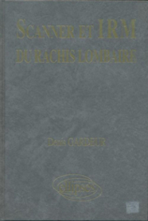 SCANNER IRM RACHIS LOMB.TEXTE